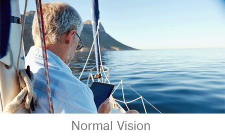 Normal Vision